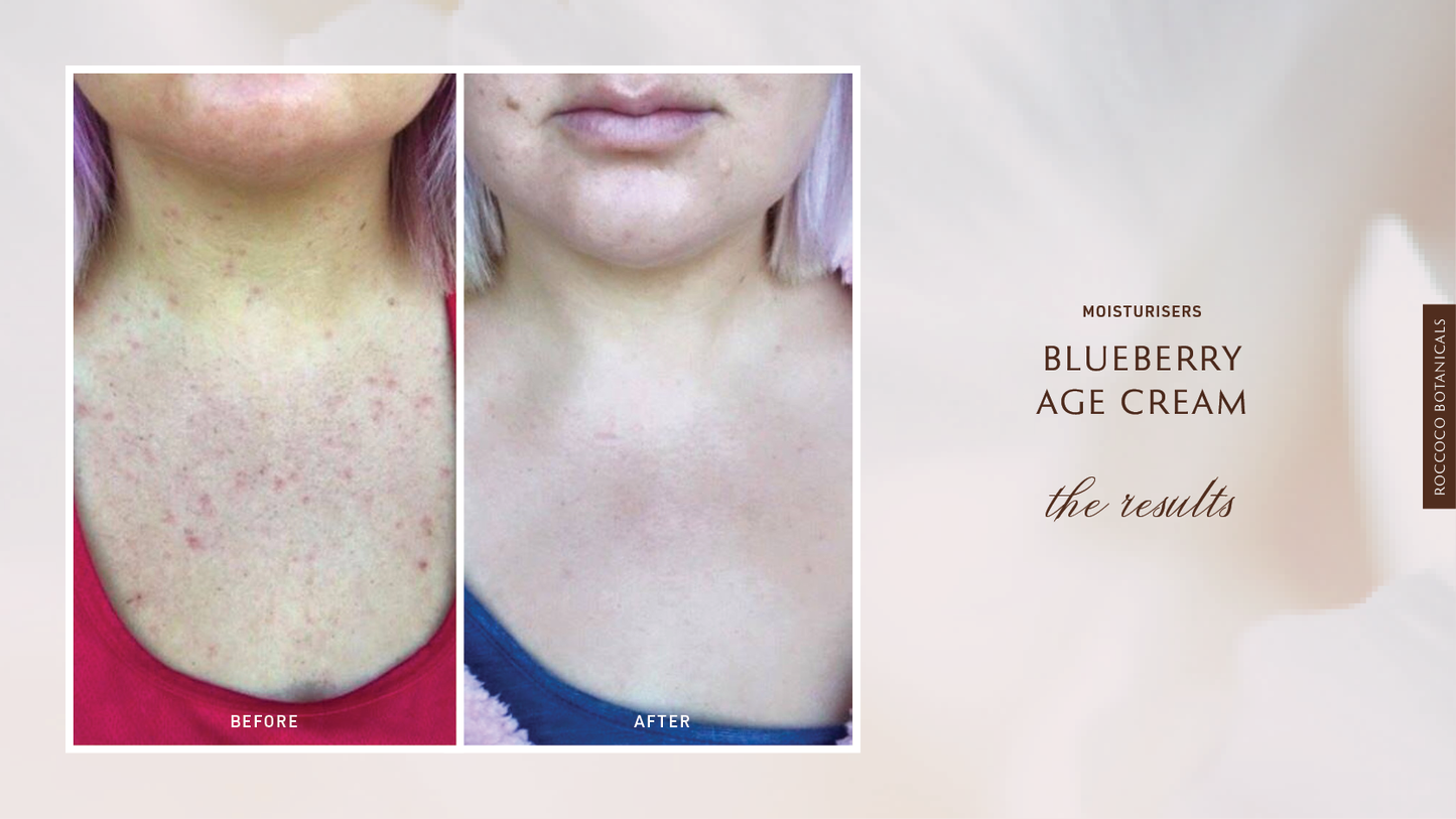 Roccoco Botanicals Blueberry AGE Cream