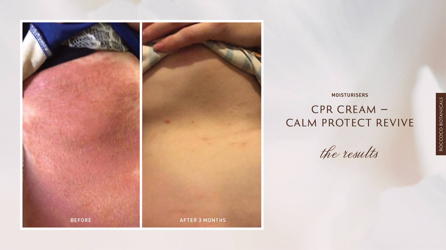 Roccoco Botanicals CPR Cream Calm Protect Revive