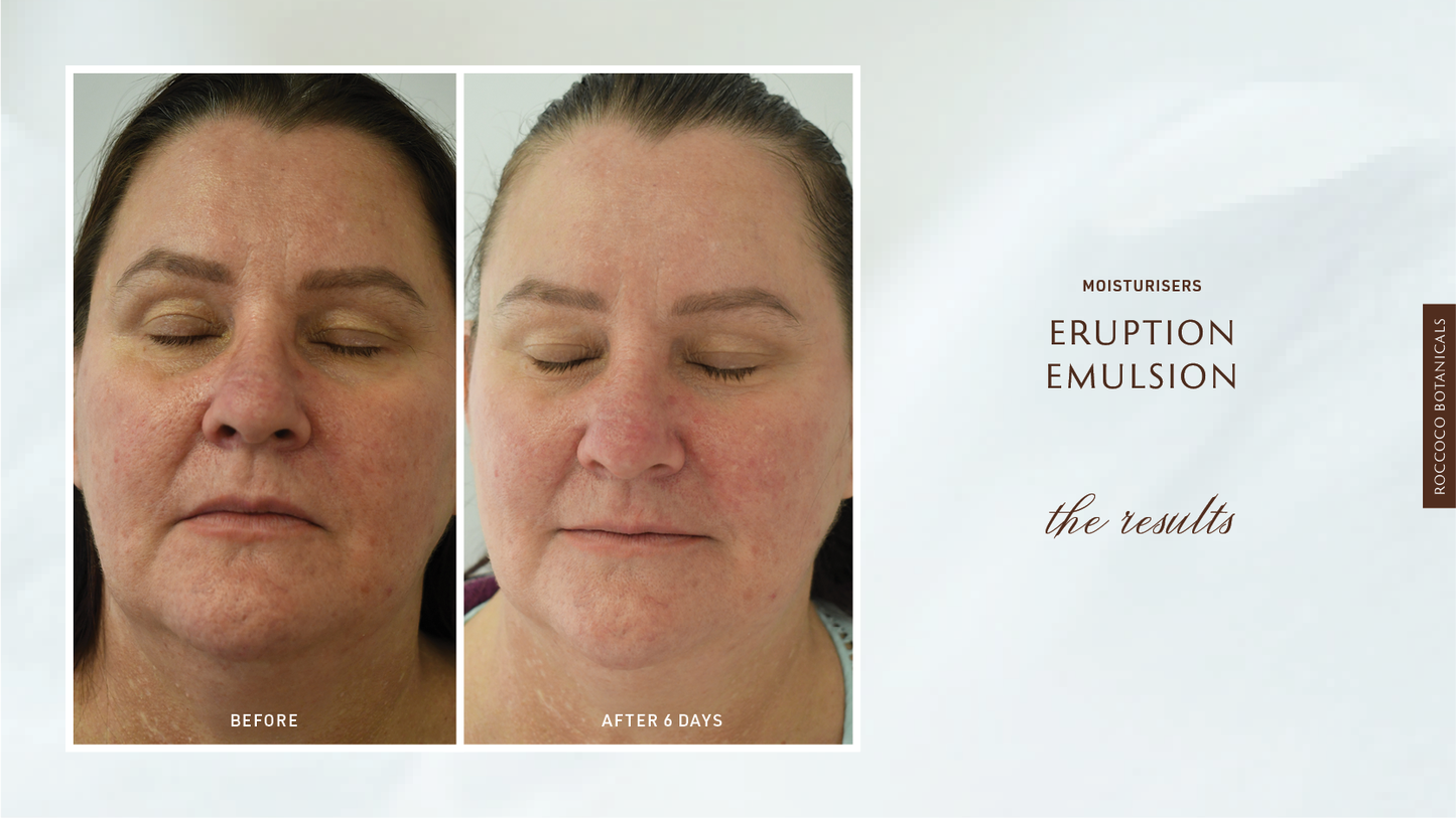 Eruption Emulsion Cream by Roccoco Botanicals