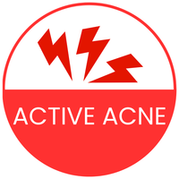 for Active Beakouts